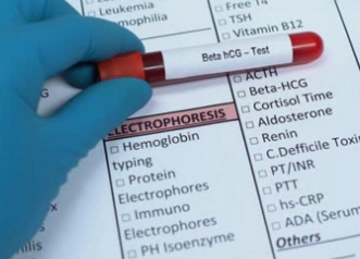 Mức hCG thấp hoặc giảm có thể báo hiệu sảy thai không?