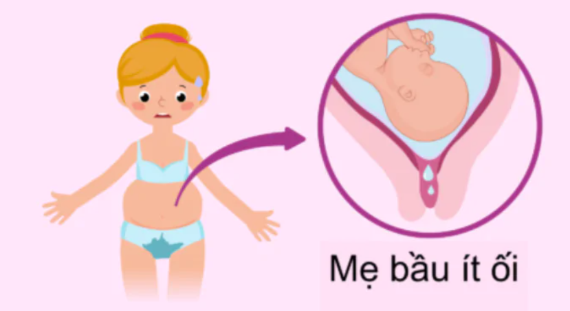 Nước ối ít (Thiểu ối): Nguyên nhân, Triệu chứng, Chẩn đoán và Điều trị