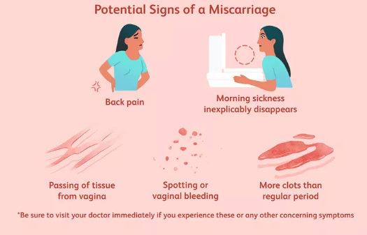 PHÂN BIỆT SẨY THAI SỚM VÀ KINH NGUYỆT