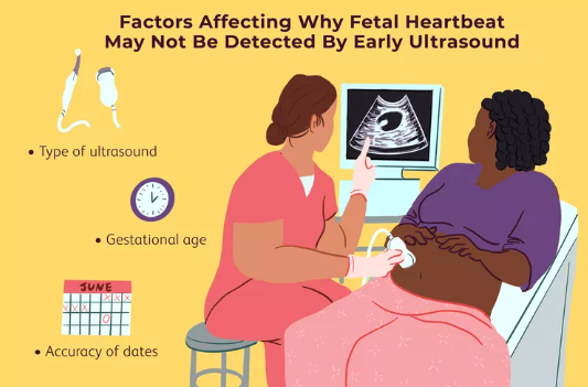 Không tim thai trên siêu âm sớm: Ý nghĩa và những điều cần biết