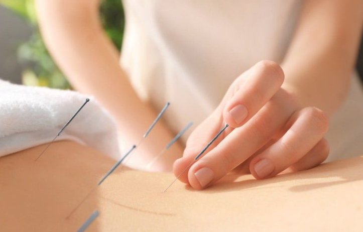 Liệu Pháp Châm Cứu Có Giúp Tôi Thụ Thai?