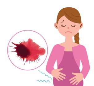 10 Câu Hỏi Thường Gặp Về Sảy Thai Được Giải Đáp (Chuyên Môn Sản Khoa)